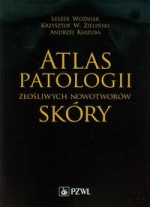 Atlas patologii złośliwych nowotworów skóry