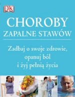 Choroby zapalne stawów. Zadbaj o swoje zdrowie, opanuj ból i żyj pełną życia