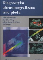 Diagnostyka ultrasonograficzna wad płodu