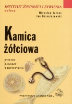 Kamica żółciowa. Porady lekarzy i dietetyków