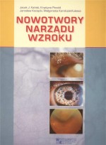 Nowotwory narządu wzroku