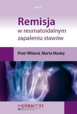 Remisja w reumatoidalnym zapaleniu stawów