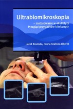 Ultrabiomikroskopia - zastosowanie w okulistyce. Przegląd przypadków klinicznych (wyd.1)