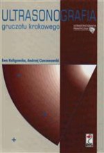 Ultrasonografia gruczołu krokowego